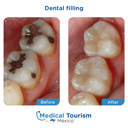 Patient before and after dental services