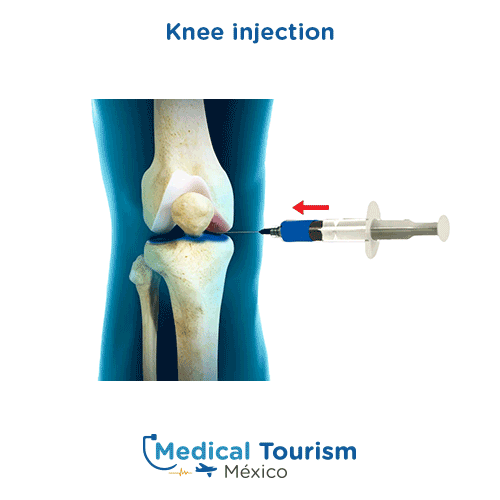 Illustrative image of Knee injection