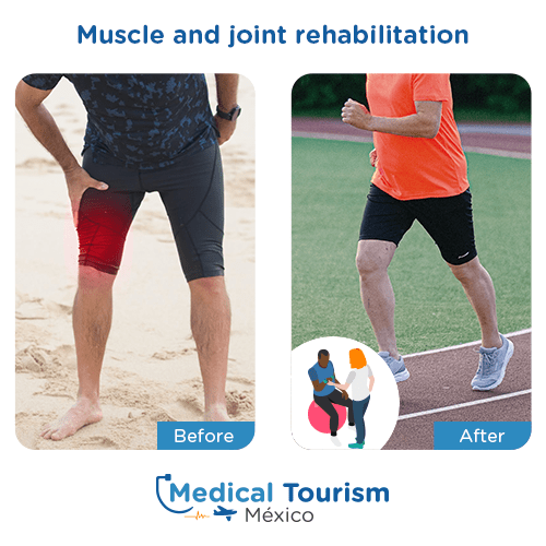 Illustrative image of muscle and joint rehabililtation