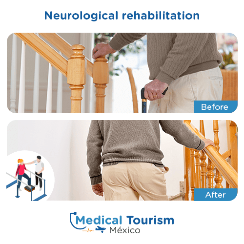 Illustrative image of neurological rehabilitation