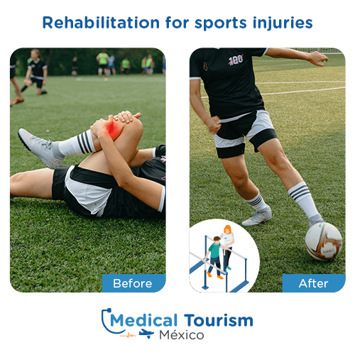 Illustrative image of Sports injury rehabilitation