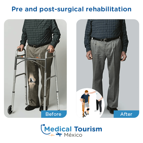 Illustrative image of Surgical rehabilitation