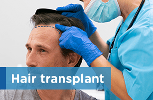 Patient having a hair transplant