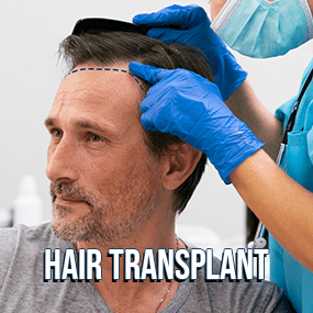 Hair transplant Medical Tourism