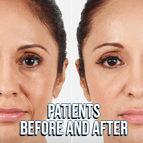 Patients Before and After