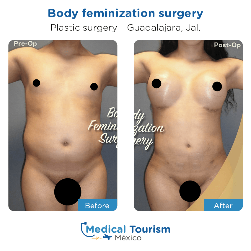 plastic surgery before and after of patients
                 in Guadalajara