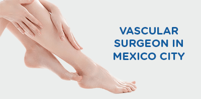 Vascular surgery in Mexico City