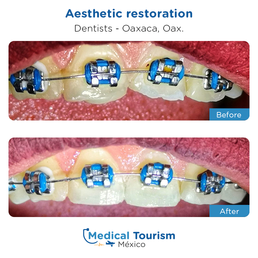 dental before and after of patients
                 in Oaxaca